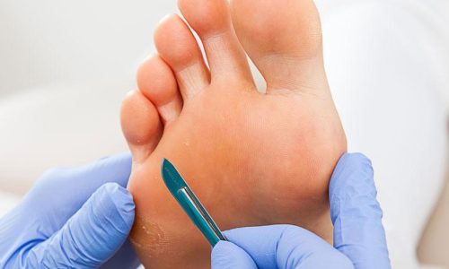 stylizacja-paznokci-callus-pell